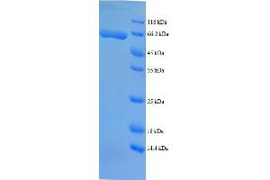 Tissue Specific Transplantation Antigen P35B (TSTA3) (AA 1-314), (partial) protein (GST tag) (TSTA3 Protein (AA 1-314, partial) (GST tag))