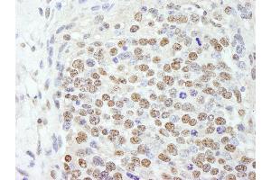 Immunohistochemistry (IHC) image for anti-Splicing Factor 3b, Subunit 2, 145kDa (SF3B2) (AA 775-825) antibody (ABIN7449024)