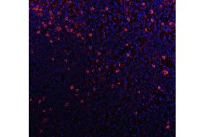 IF analysis of CD79b using anti-CD79b antibody (ABIN3043398).