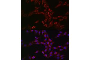 Immunofluorescence analysis of NIH/3T3 cells using CHMP6 Rabbit pAb (ABIN6133624, ABIN6138551 and ABIN7101747) at dilution of 1:100 (40x lens). (CHMP6 antibody)