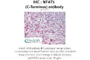 Image no. 1 for anti-Nuclear Factor of Activated T-Cells 5, Tonicity-Responsive (NFAT5) antibody (ABIN1737328)