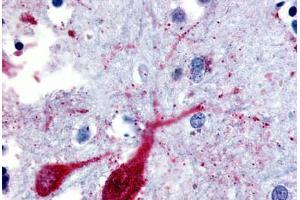 Human Brain, Cortex (formalin-fixed, paraffin-embedded) stained with SLC5A9 antibody ABIN213409 at 20 ug/ml followed by biotinylated goat anti-rabbit IgG secondary antibody ABIN481713, alkaline phosphatase-streptavidin and chromogen. (SLC5A9 antibody  (Cytoplasmic Domain))