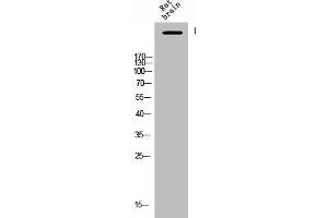 Western Blot analysis of Rat-brain cells using Phospho-IP3R-I (S1764) Polyclonal Antibody (ITPR1 antibody  (pSer1764))