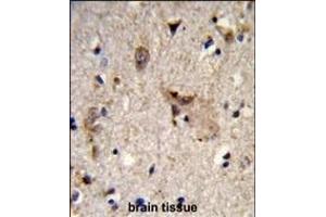 Formalin-fixed and paraffin-embedded human brain tissue reacted with ALDH18A1 Antibody (Center), which was peroxidase-conjugated to the secondary antibody, followed by DAB staining.