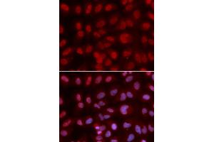 Immunofluorescence analysis of U2OS cell using SIN3A antibody. (SIN3A antibody  (AA 1-120))