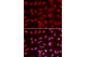 Immunofluorescence analysis of U2OS cell using SIN3A antibody.