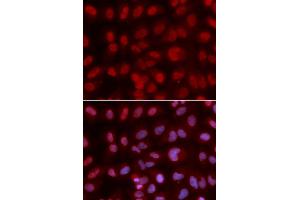 Immunofluorescence analysis of U2OS cell using SIN3A antibody. (SIN3A antibody  (AA 1-120))