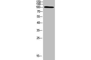 Western Blot analysis of HEPG2 cells using Antibody diluted at 500 (TRPV4 antibody  (AA 461-510))