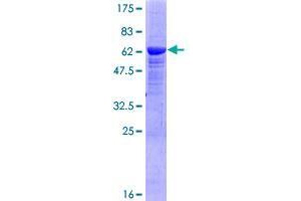 PKDCC Protein (AA 1-294) (GST tag)