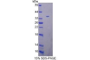 Image no. 1 for Peptidyl Arginine Deiminase, Type IV (PADI4) (AA 1-300) protein (His tag) (ABIN6240005) (PAD4 Protein (AA 1-300) (His tag))