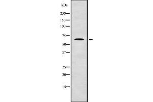 Western blot analysis of LINGO2 using COLO205 whole cell lysates (LINGO2 antibody  (Internal Region))