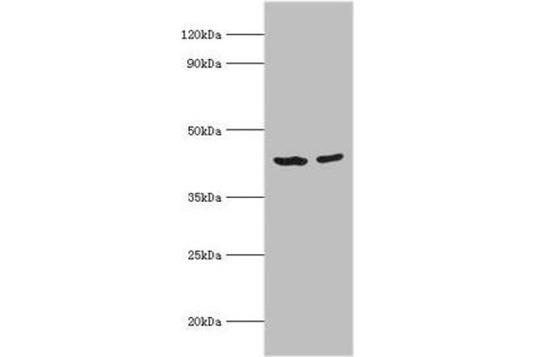 ACADS antibody  (AA 1-260)