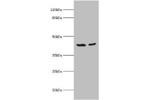 Western blot All lanes: Short-chain specific acyl-CoA dehydrogenase, mitochondrial antibody at 7 μg/mL Lane 1: 293T whole cell lysate Lane 2: HepG2 whole cell lysate Secondary Goat polyclonal to rabbit IgG at 1/10000 dilution Predicted band size: 44 kDa Observed band size: 44 kDa (ACADS antibody  (AA 1-260))