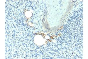 Formalin-fixed, paraffin-embedded human Spleen stained with TRAcP Mouse Monoclonal Antibody (ACP5/1070). (ACP5 antibody)