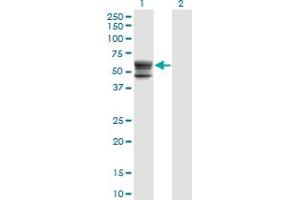 Western Blot analysis of CHST12 expression in transfected 293T cell line by CHST12 monoclonal antibody (M01), clone 3D6.
