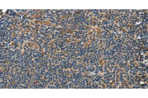 Immunohistochemistry of paraffin-embedded Human tonsil tissue using GRB7 Polyclonal Antibody at dilution 1:40 (GRB7 antibody)