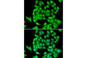 Immunofluorescence analysis of HeLa cells using NEK3 antibody. (NEK3 antibody  (AA 267-506))