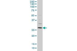 DKK1 monoclonal antibody (M06), clone 4C10 Western Blot analysis of DKK1 expression in HeLa