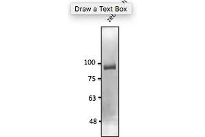 Western Blotting (WB) image for anti-Cadherin 11 (CDH11) (C-Term) antibody (ABIN6254204) (OB Cadherin antibody  (C-Term))