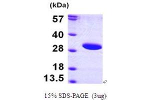 SDS-PAGE (SDS) image for Sirtuin 3 (SIRT3) (AA 118-399) protein (His tag) (ABIN667166)