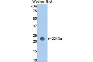 Western blot analysis of the recombinant protein. (IL13 Receptor alpha 1 antibody  (AA 201-360))