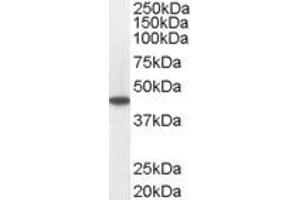 ABIN184850 staining (0. (Medium-Chain Specific Acyl-CoA Dehydrogenase, Mitochondrial (C-Term) antibody)