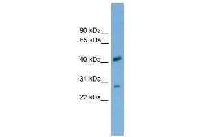 Western Blot showing SLC25A37 antibody used at a concentration of 1-2 ug/ml to detect its target protein. (SLC25A37 antibody  (Middle Region))