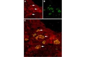 Expression of TRPV6 in rat DRG - Immunohistochemical staining of rat dorsal root ganglion (DRG) using Anti-TRPV6 Antibody (ABIN7043857, ABIN7043998 and ABIN7043999), (1:100). (TRPV6 antibody  (Intracellular))