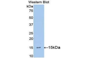 Western Blotting (WB) image for anti-Interleukin 15 (IL15) (AA 49-162) antibody (ABIN3209515) (IL-15 antibody  (AA 49-162))