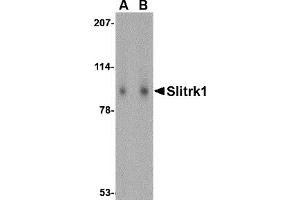 Western Blotting (WB) image for anti-SLIT and NTRK-Like Family, Member 1 (SLITRK1) (Middle Region) antibody (ABIN1031098) (SLITRK1 antibody  (Middle Region))