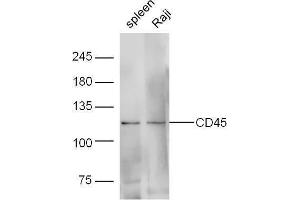 Lane 1: Mouse spleen lysates; Lane 2: Human raji lysates probed with Rabbit Anti-CD45 Polyclonal Antibody, Unconjugated  at 1:5000 for 90 min at 37˚C. (CD45 antibody  (AA 1210-1304))