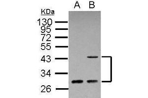 WB Image Sample (30 ug of whole cell lysate) A: A431 B: HeLa 12% SDS PAGE antibody diluted at 1:500 (ING1 antibody  (C-Term))