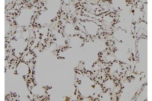 ABIN6277041 at 1/100 staining Rat lung tissue by IHC-P. (LHX8 antibody  (Internal Region))