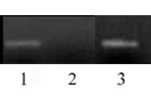 Histone H3 monomethyl Lys4 antibody (mAb) tested by ChIP. (Histone 3 antibody  (H3K4me))