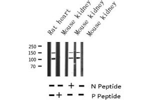 Western blot analysis of Phospho-IGF1R (Tyr1161) expression in various lysates (IGF1R antibody  (pTyr1161))