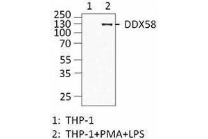 Western Blotting (WB) image for anti-DEAD (Asp-Glu-Ala-Asp) Box Polypeptide 58 (DDX58) antibody (ABIN2664928) (DDX58 antibody)