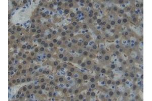 Detection of AST in Rat Liver Tissue using Polyclonal Antibody to Aspartate Aminotransferase (AST) (GOT1 antibody  (AA 1-413))