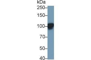 Detection of LEPR in Rat Cerebrum lysate using Polyclonal Antibody to Leptin Receptor (LEPR) (Leptin Receptor antibody  (AA 22-203))