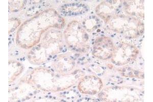 Detection of CTSG in Human Kidney Tissue using Polyclonal Antibody to Cathepsin G (CTSG) (Cathepsin G antibody  (AA 21-255))