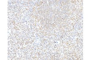 Immunohistochemistry (IHC) image for anti-CCCTC-Binding Factor (Zinc Finger Protein) (CTCF) (AA 650-700) antibody (ABIN7453967)