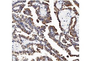 IHC analysis of VAPB using anti-VAPB antibody (ABIN5693292). (VAPB antibody  (AA 2-55))