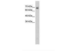 Image no. 1 for anti-Collapsin Response Mediator Protein 1 (CRMP1) (N-Term) antibody (ABIN6736348) (CRMP1 antibody  (N-Term))