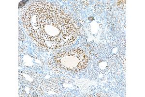 Immunohistochemistry (IHC) image for anti-Poly (ADP-Ribose) Polymerase 1 (PARP1) (AA 750-800) antibody (ABIN7449531) (Recombinant PARP1 antibody  (AA 750-800))