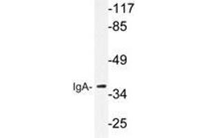 Western blot analysis of IgA antibody in extracts from HeLa cells.
