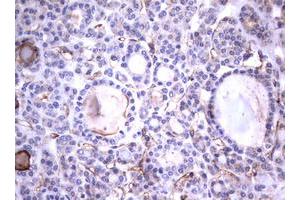Image no. 1 for anti-Tumor Necrosis Factor Receptor Superfamily, Member 8 (TNFRSF8) (AA 19-379) antibody (ABIN1491085) (TNFRSF8 antibody  (AA 19-379))