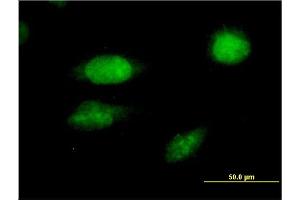 Immunofluorescence of monoclonal antibody to FOXC2 on HeLa cell. (FOXC2 antibody  (AA 421-501))
