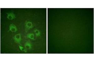 Immunofluorescence analysis of HuvEc cells, using CrkL (Phospho-Tyr207) Antibody. (CrkL antibody  (pTyr207))