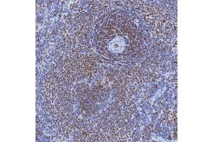 IHC analysis of TRMT61A using anti-TRMT61A antibody (ABIN7599220). (TRMT61A antibody  (AA 1-289))