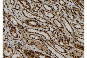 ABIN6260151 and ABIN6279148 at 1/100 staining Human kidney tissue by IHC-P. (ATXN7L1 antibody  (Internal Region))