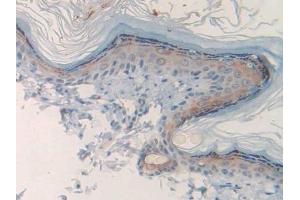 Immunohistochemistry (IHC) image for anti-Muscarinic Acetylcholine Receptor M1 (CHRM1) (AA 210-363) antibody (ABIN7438109)